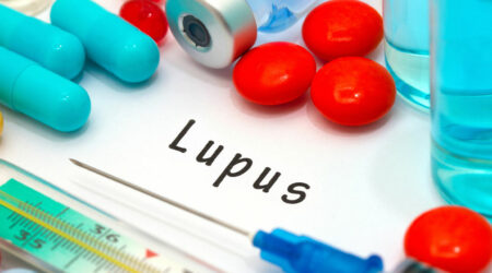 Lupus – Symptoms, Risk Factors, and Diagnosis