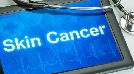 Skin cancer – Types and warning signs