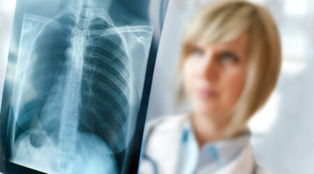 Signs and symptoms that may indicate lung diseases